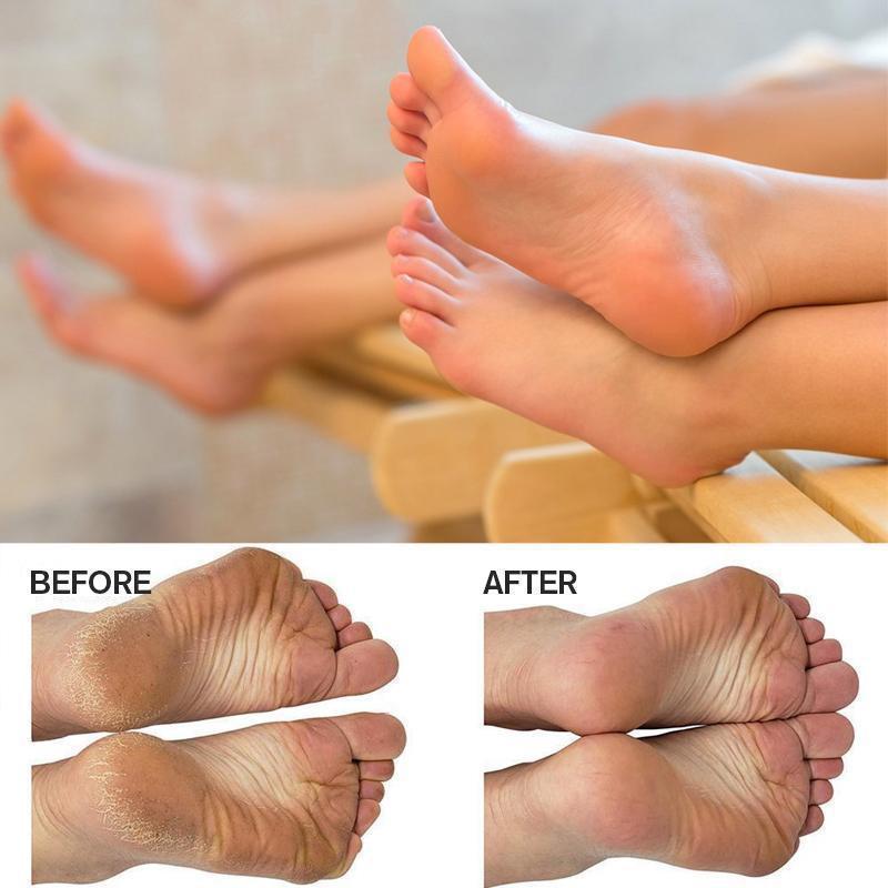 Foot Scrubber Brush - Feet SPA Massager