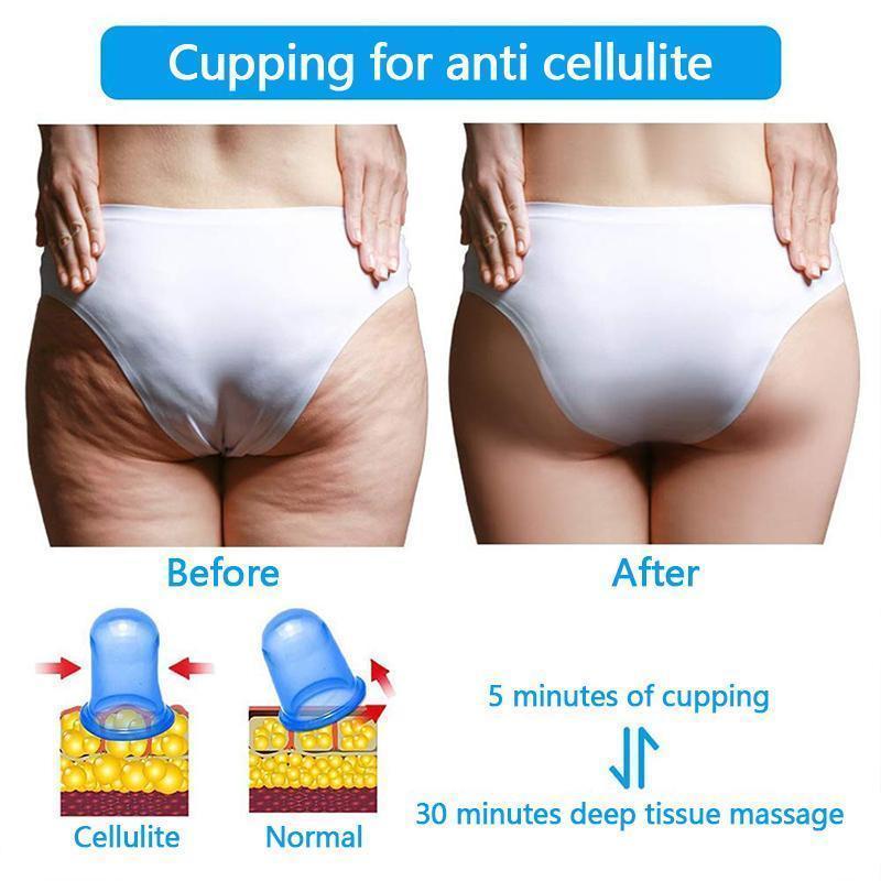 Massage Slim Cup