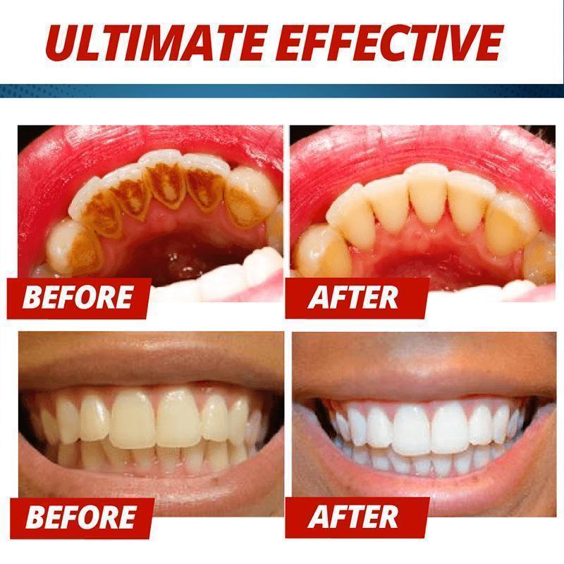 Intensive Stain Removal Whitening Toothpaste